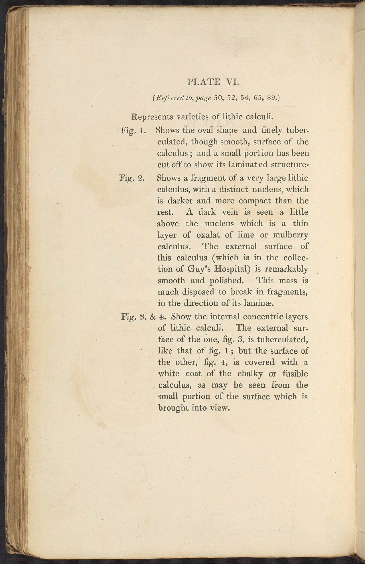 Alexander marcet 1770 1822 was a genevan physician who speci