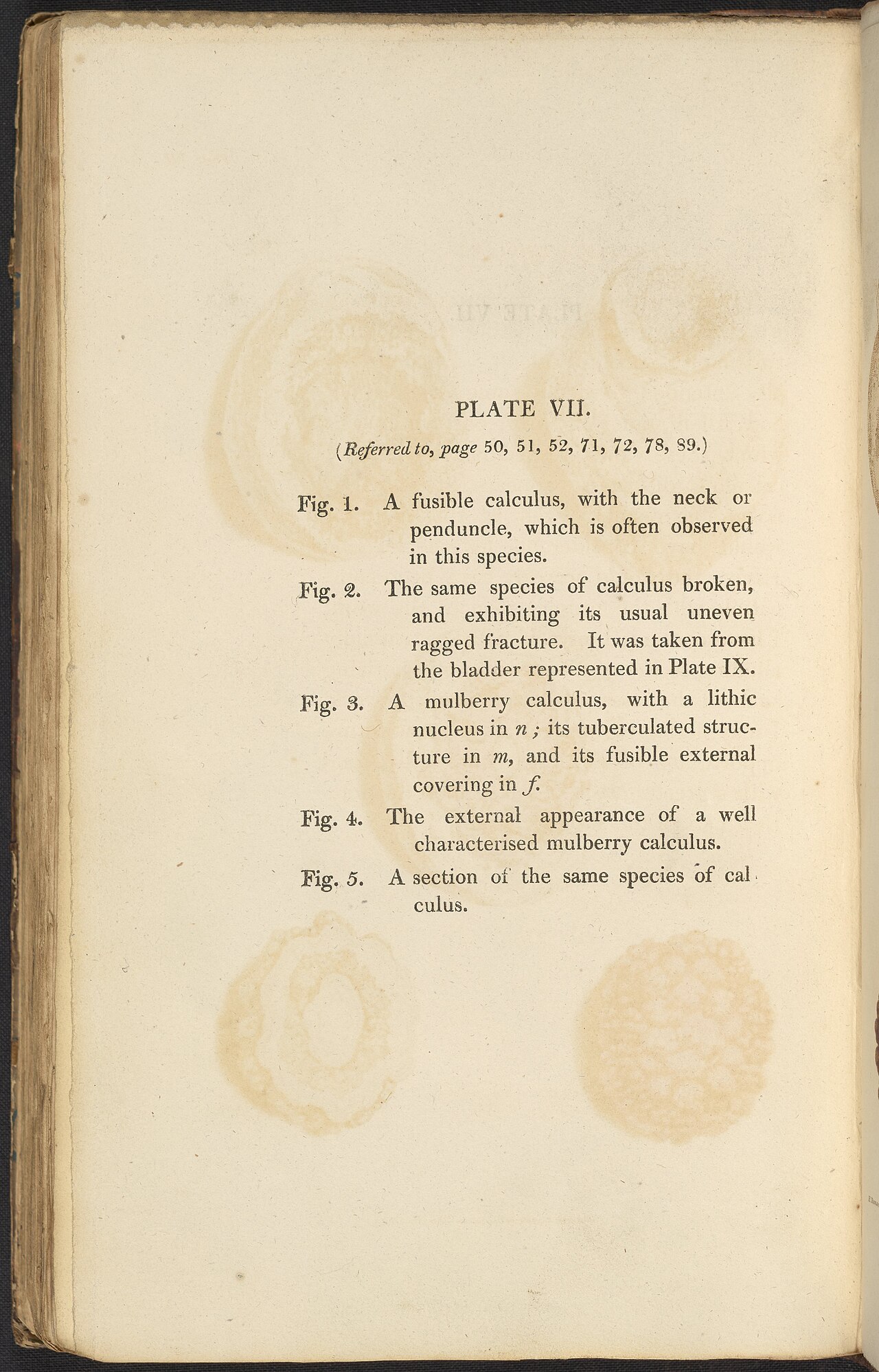 Alexander marcet 1770 1822 was a genevan physician who speci