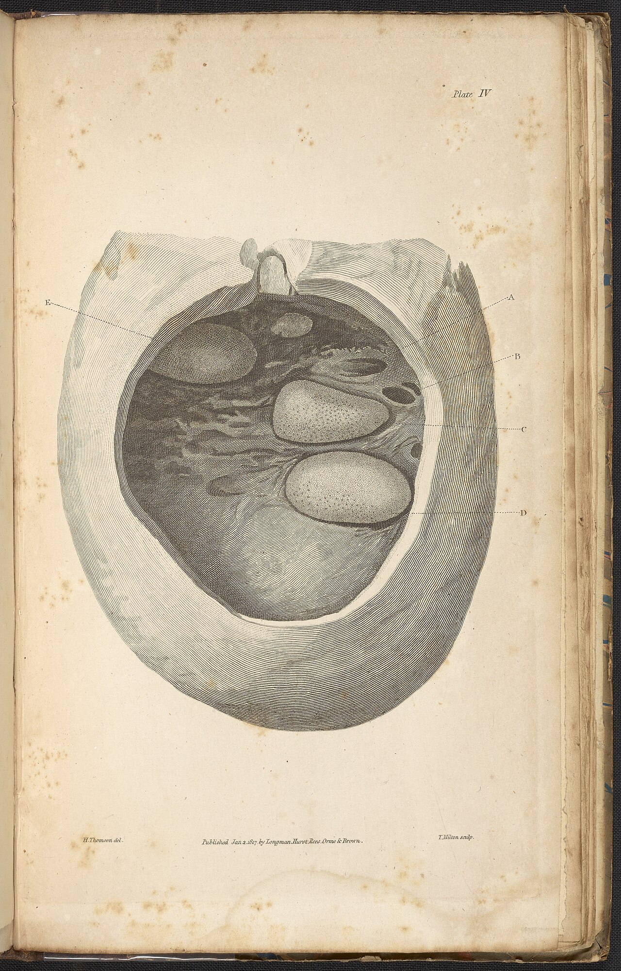 Alexander marcet 1770 1822 was a genevan physician who speci