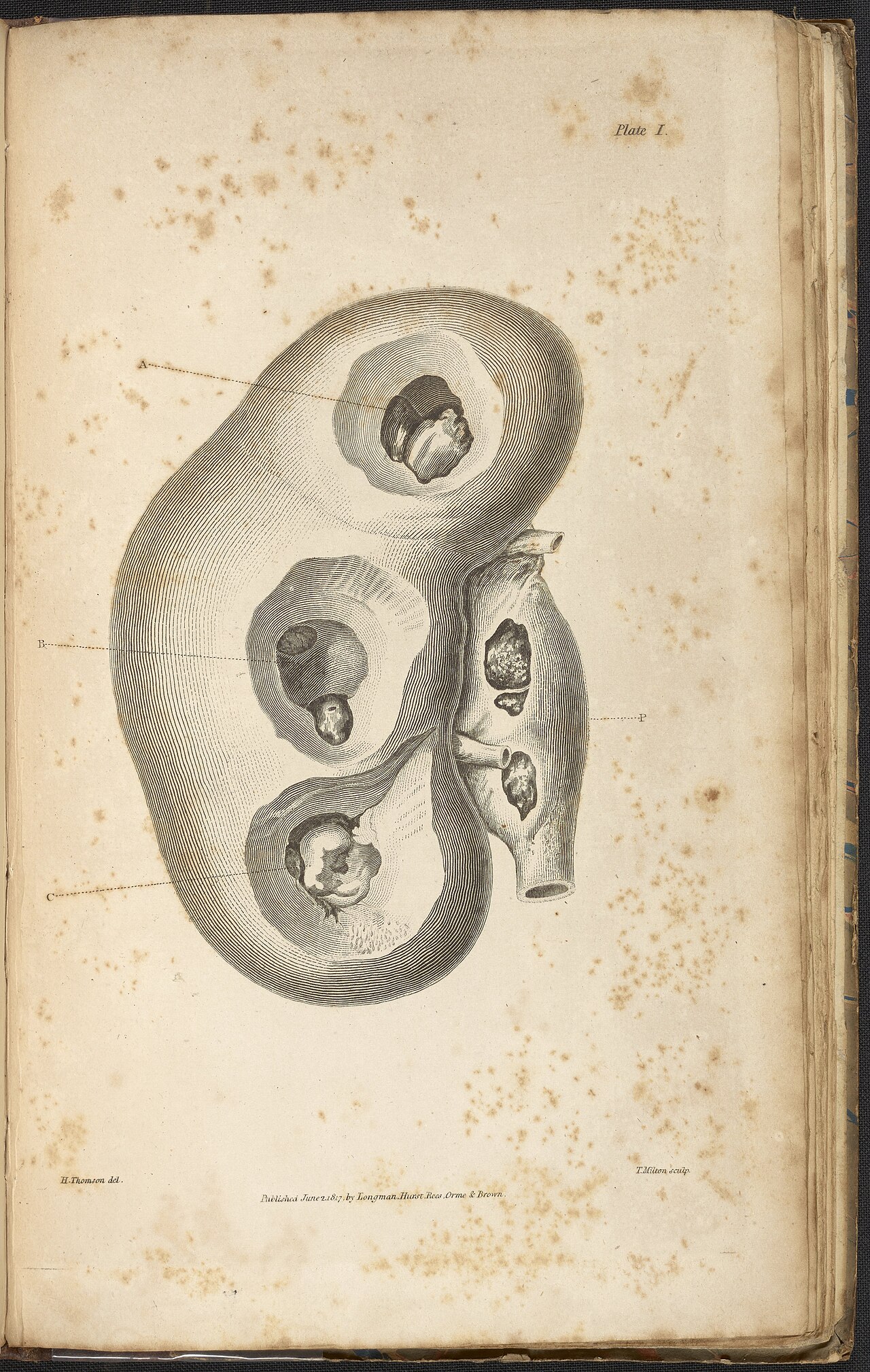 Alexander marcet 1770 1822 was a genevan physician who speci