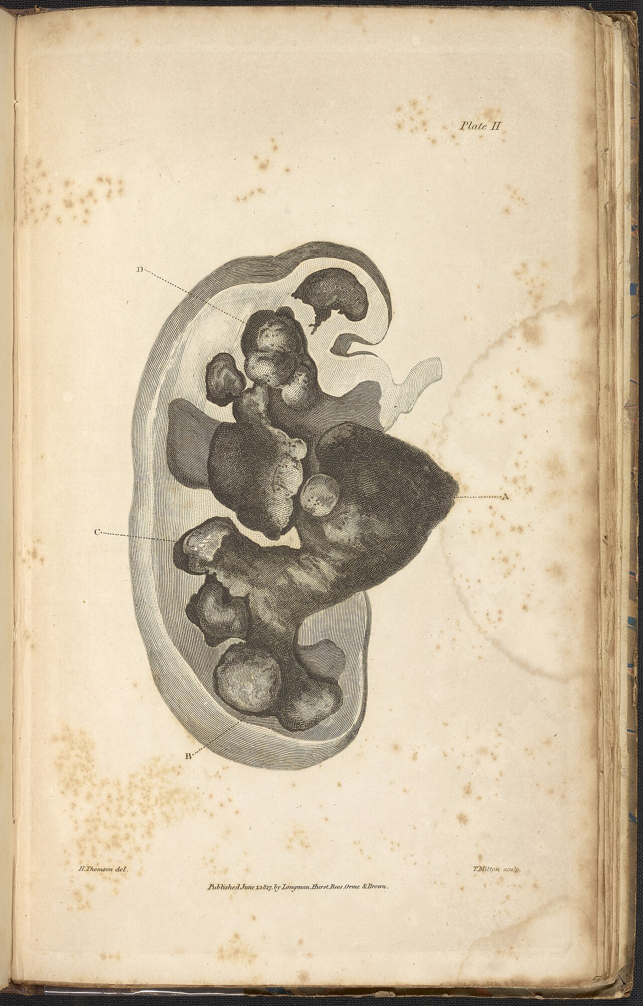 Alexander marcet 1770 1822 was a genevan physician who speci