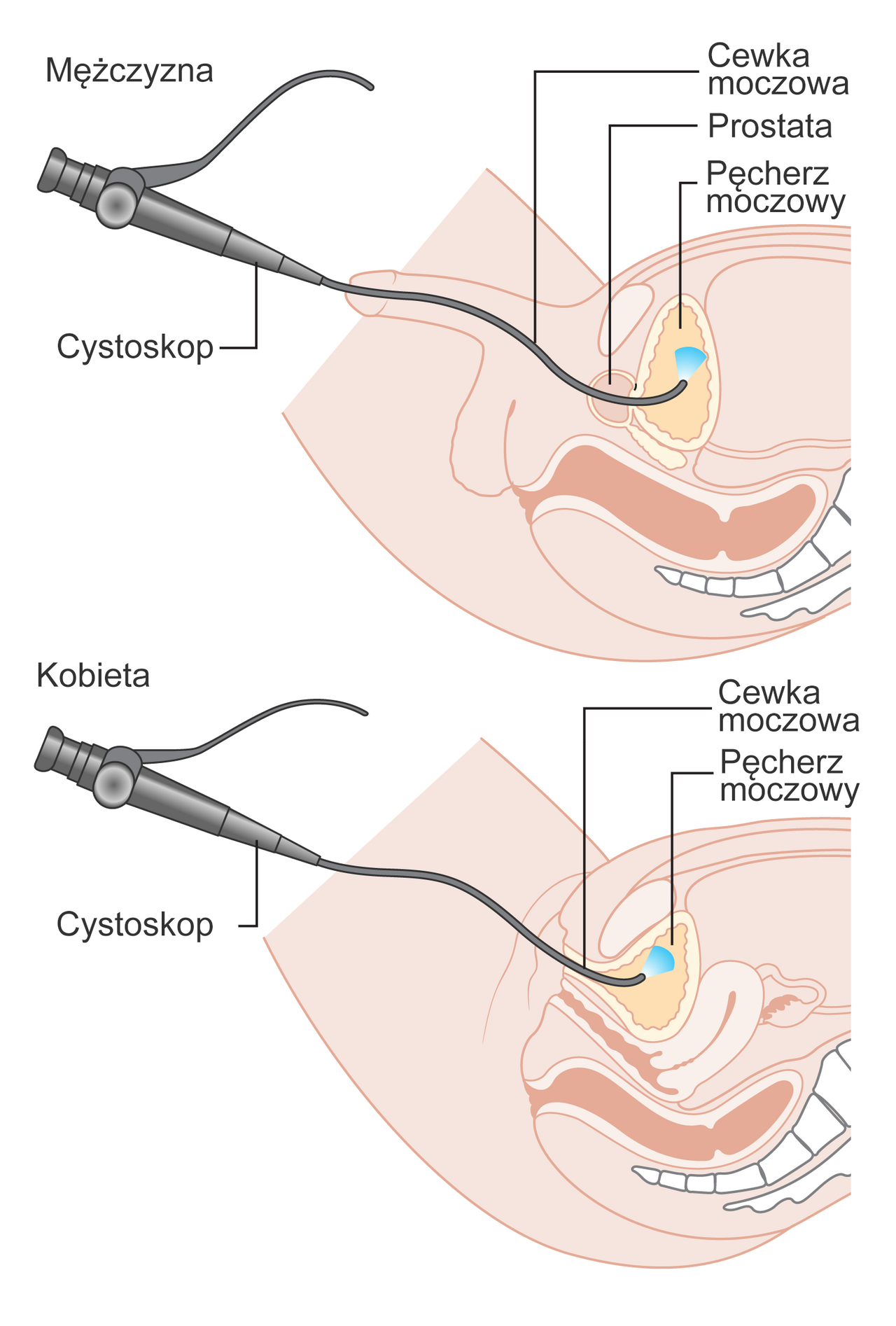 Diagram przedstawiaj cy cystoskopi u m czyzny i kobiety