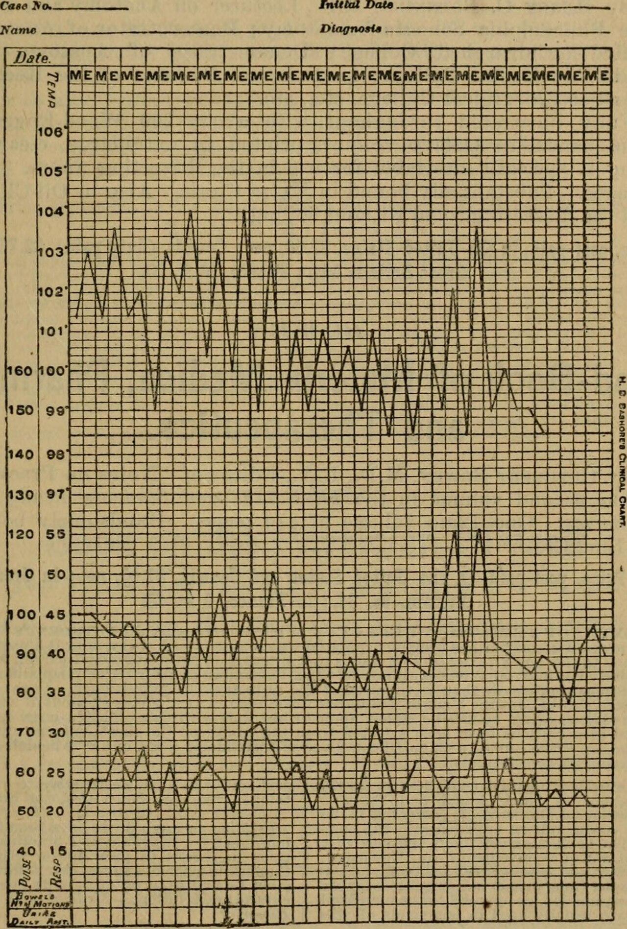 Plotting of temperature pulse and respiration identifier tre