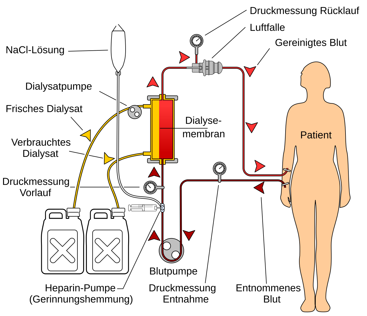 Simplified hemodialysis circuit