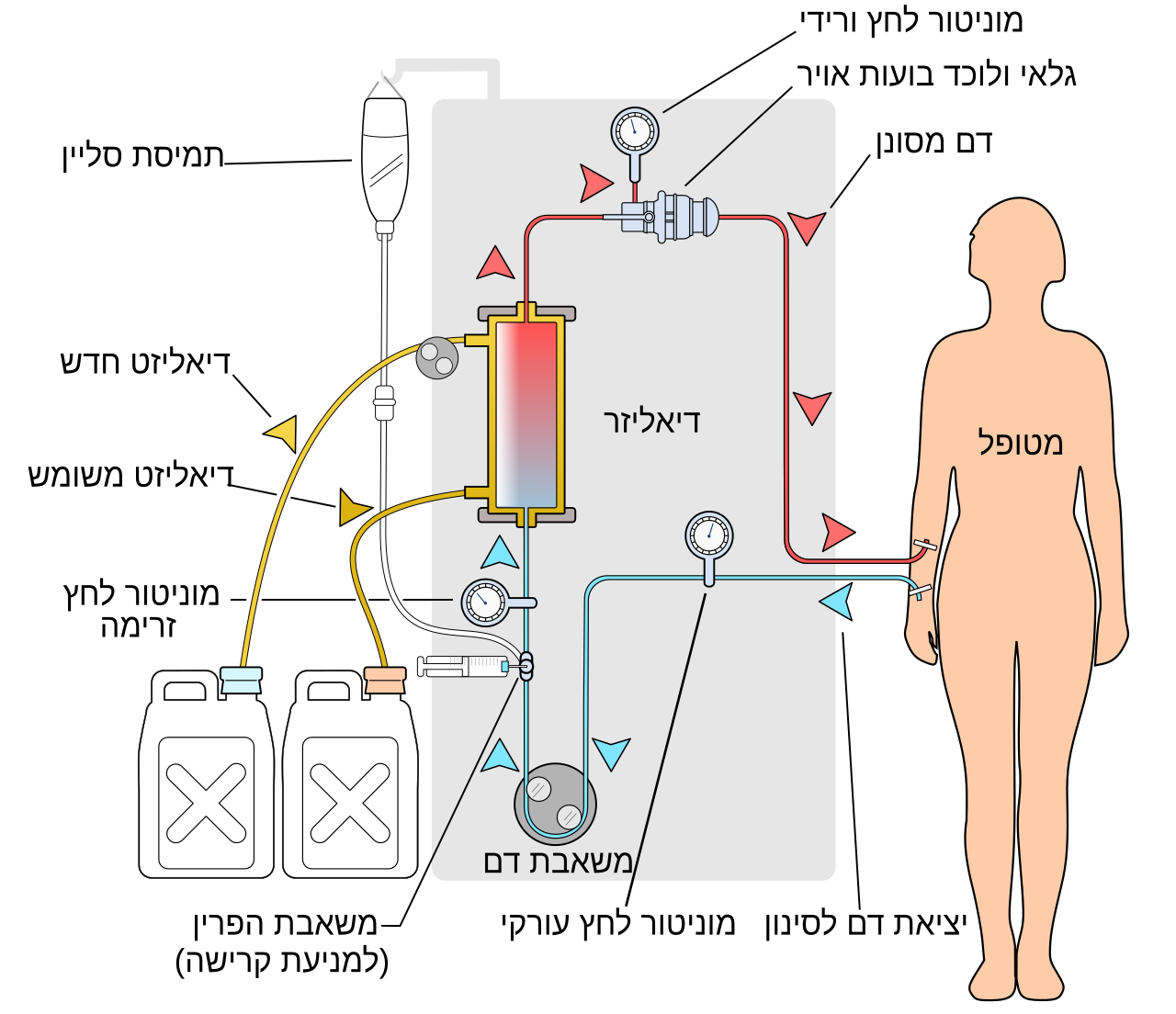 Simplified hemodialysis circuit