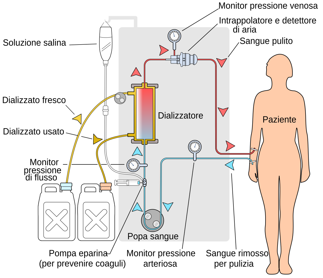 Simplified hemodialysis circuit